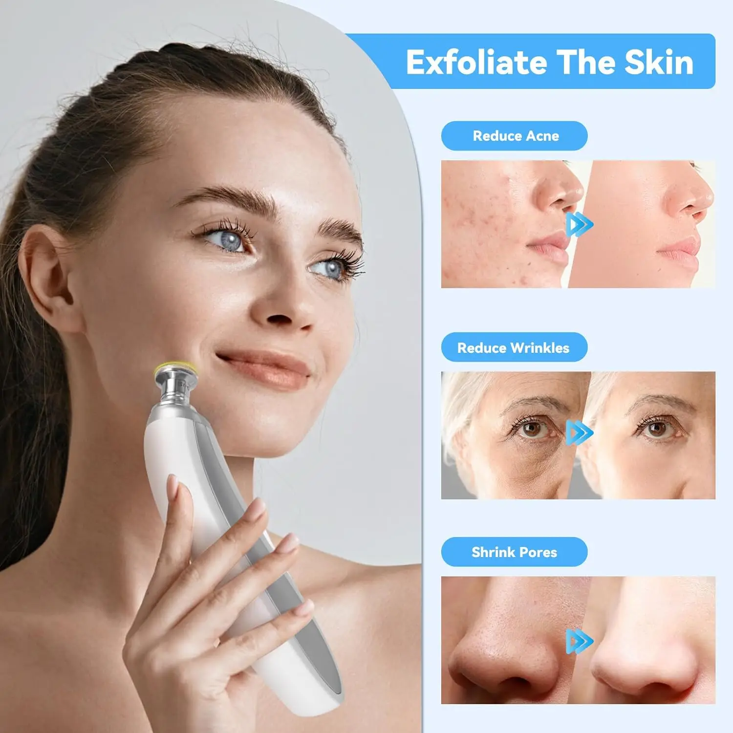 itsskk | Professional Diamond Microdermabrasion Resurfacing System thumbnail 1