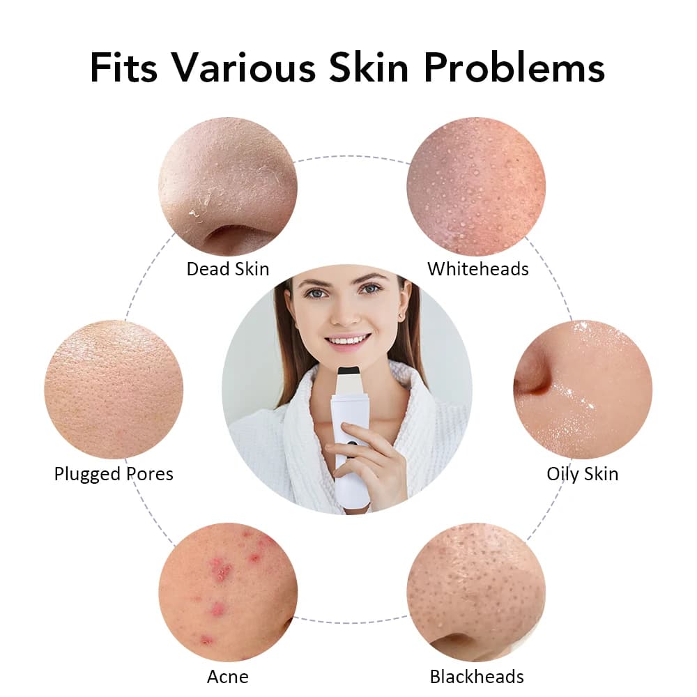 itsskk | Professional Ultrasonic Facial Spatula and Dermal Purifier thumbnail 4