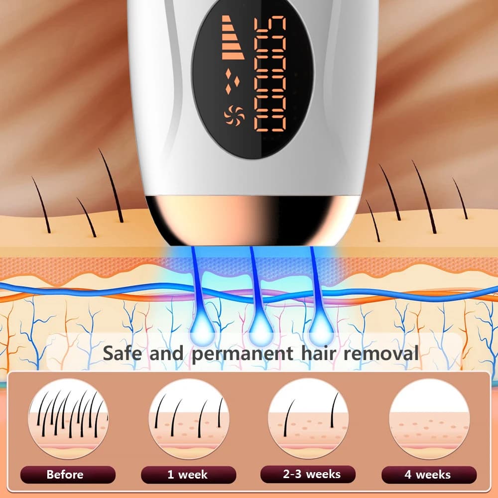 itsskk | Professional Clinical IPL Hair Removal System thumbnail 2
