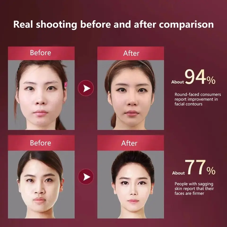 itsskk | Professional V-Line Phototherapy and Sculpting Massager thumbnail 5