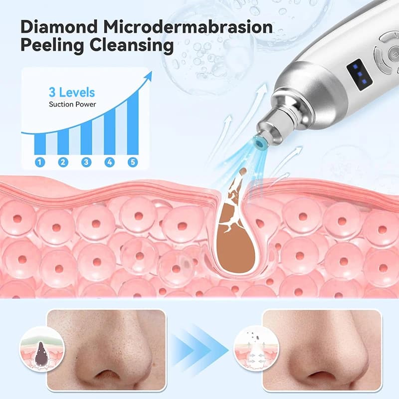 itsskk | Professional Diamond Microdermabrasion Resurfacing System thumbnail 2