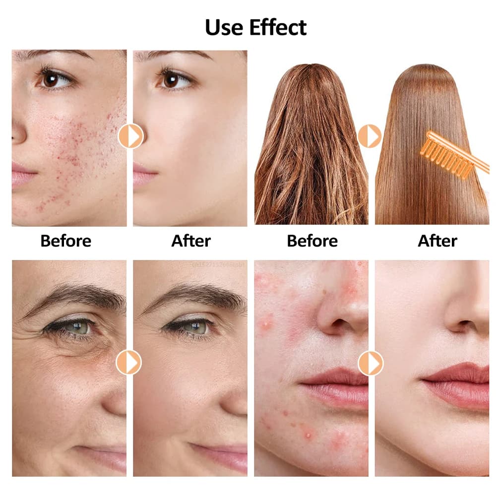 itsskk | Professional 6-in-1 Clinical High Frequency Electrotherapy System thumbnail 5